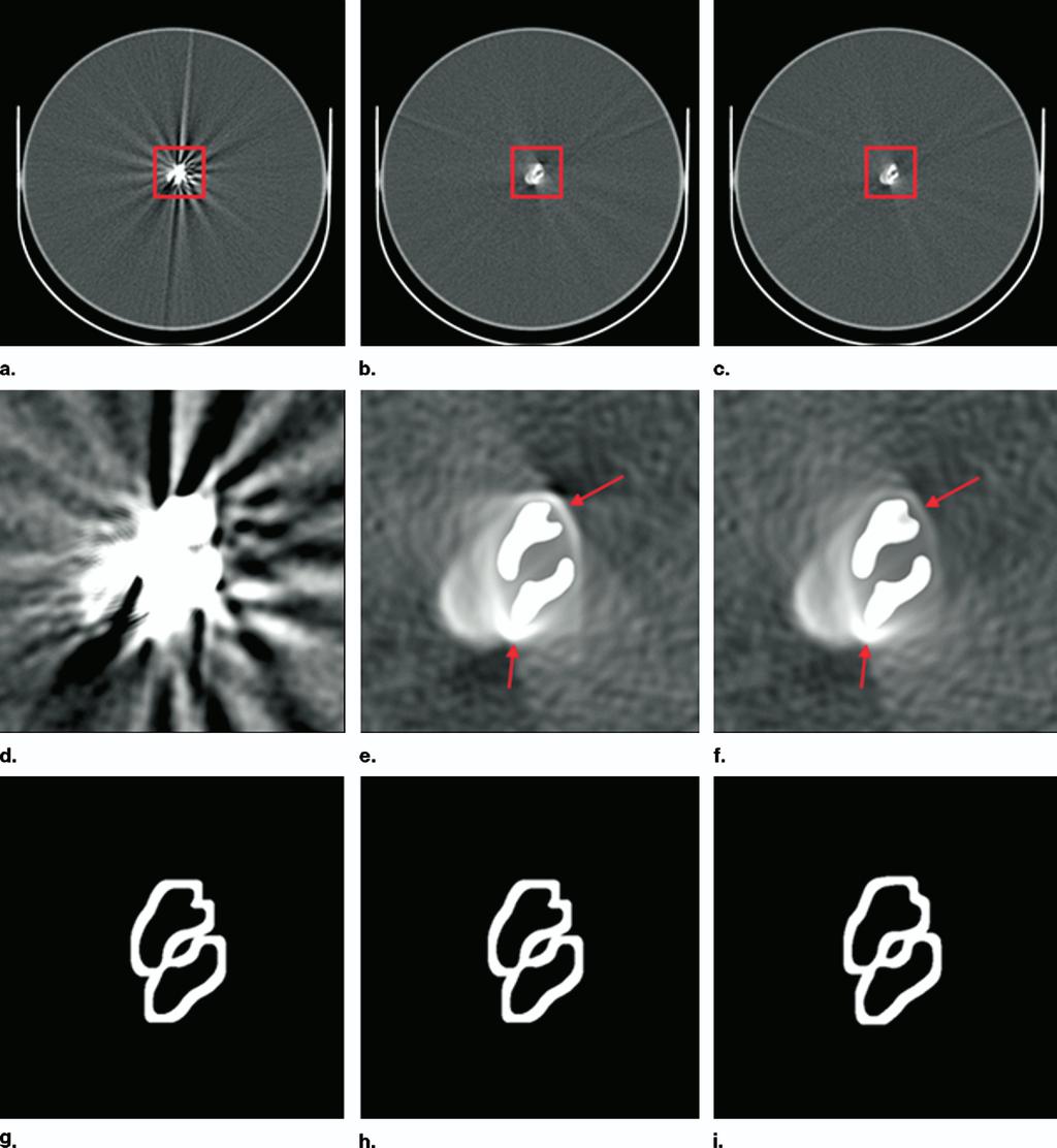 Academic Radiology, Vol 14, No 4, April 2007 SEGMENTATION-BASED METHOD Figure 5. Representative images of the clip phantom reconstructed using different methods.