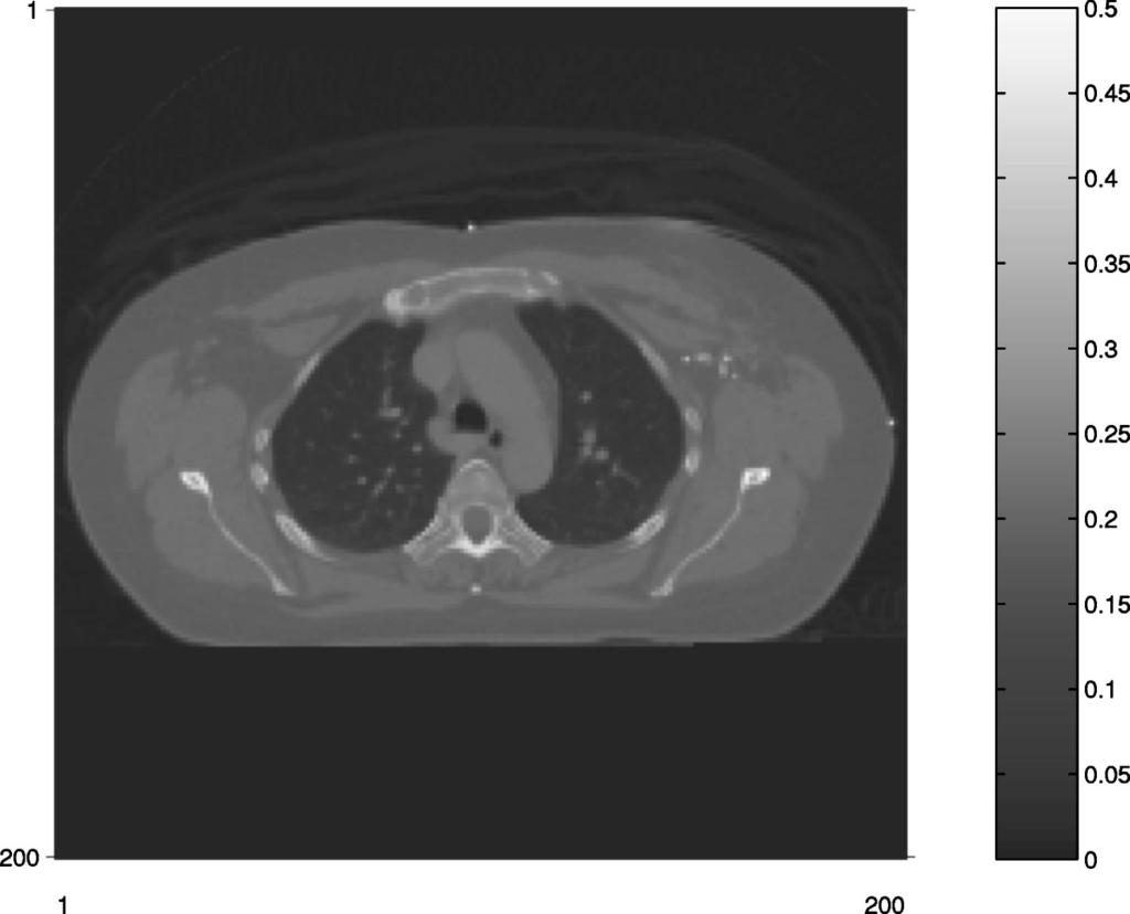 987 Zeng, Fessler, and Balter: Respiratory motion estimation from slowly rotating x-ray projections 987 FIG. 1. The reference CT image f ref. IV.