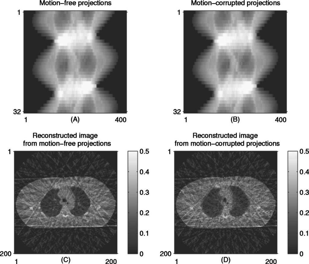 988 Zeng, Fessler, and Balter: Respiratory motion estimation from slowly rotating x-ray projections 988 FIG. 2. Illustration of motion effects in image reconstruction.