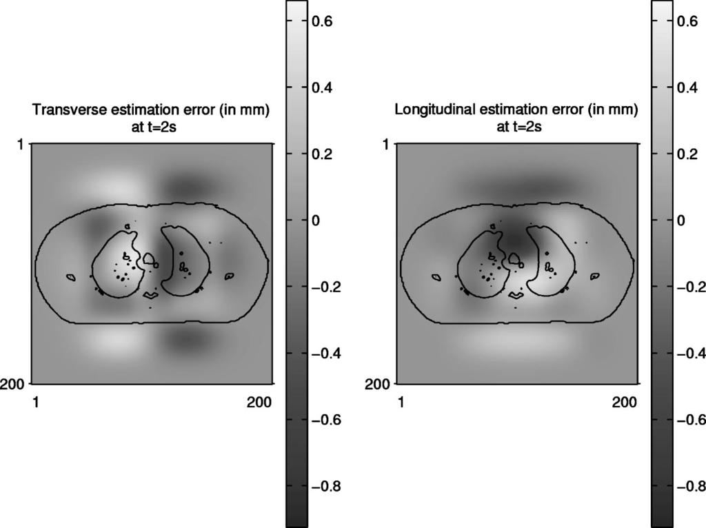 989 Zeng, Fessler, and Balter: Respiratory motion estimation from slowly rotating x-ray projections 989 FIG. 3.