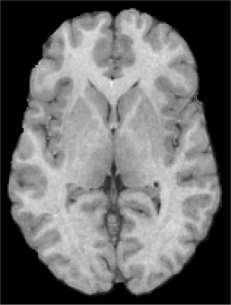 Real MRI image