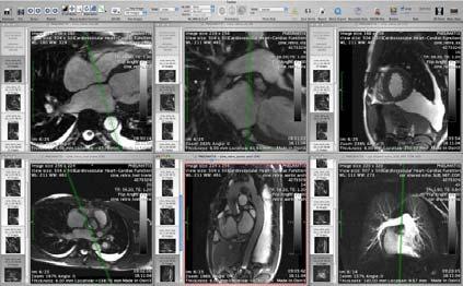 Volview, shown in Figure 11 allows for the visualization of different medical data such as DICOM files.