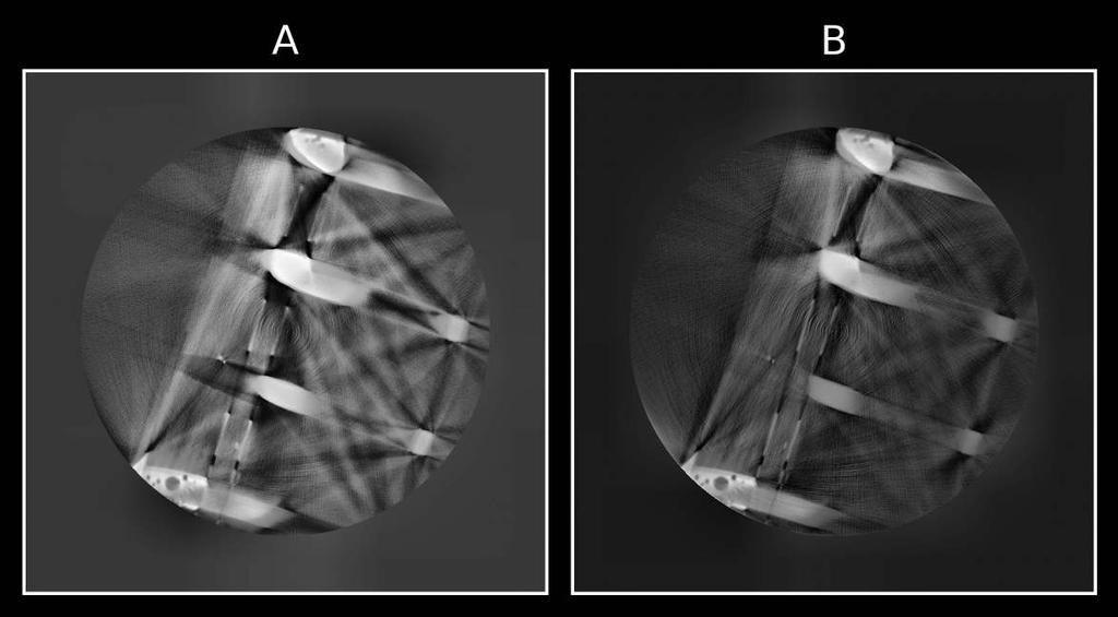 Figure 2: Example of a contrast enhanced image from the user study. A and B randomly denoted the two different methods for blind assessment.
