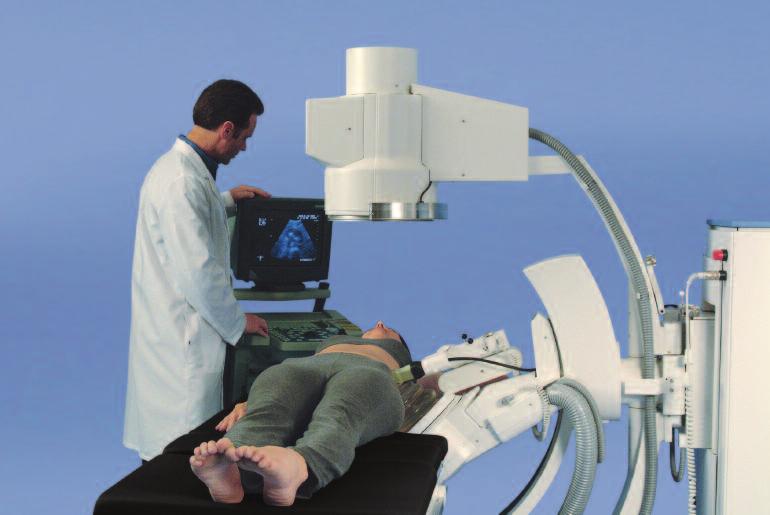 Compact DeltaII Optimal Imaging Isocentric Ultrasound Use of the optional, patented localization ultrasound arm optimizes positioning flexibility and stone imaging.