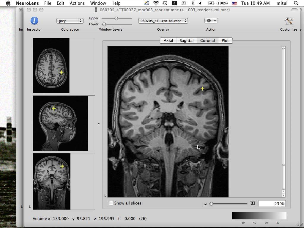 Starting NeuroLens MIT 9.17: Systems Neuroscience Laboratory 1. Open the NeuroLens program by double-clicking on the NeuroLens icon on the desktop. Loading Data Sets 1.
