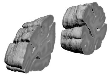 HNSP: Results 3D elastic registration of a part of the visual cortex 2 hemispheres;