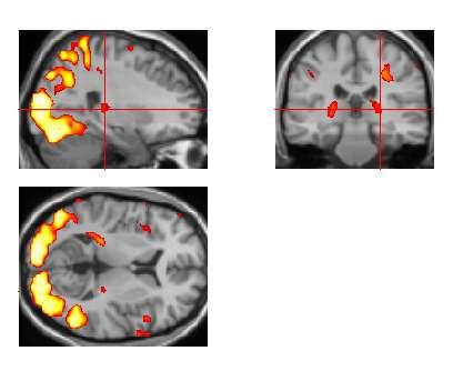 Overview of SPM for fmri SNR &