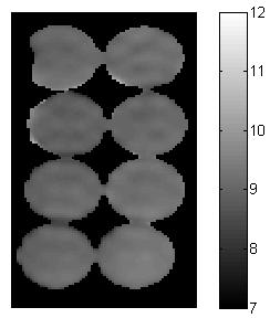 Fat fraction map is generated with bias corrected fat and water images. Results: The flip angle map of an acquisition with prescribed flip angle of 12 degrees is shown in FIG 5.