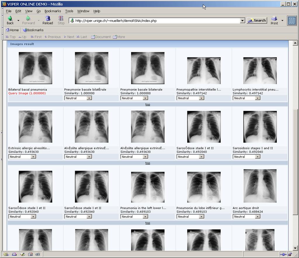 Example interface Query image Diagnosis