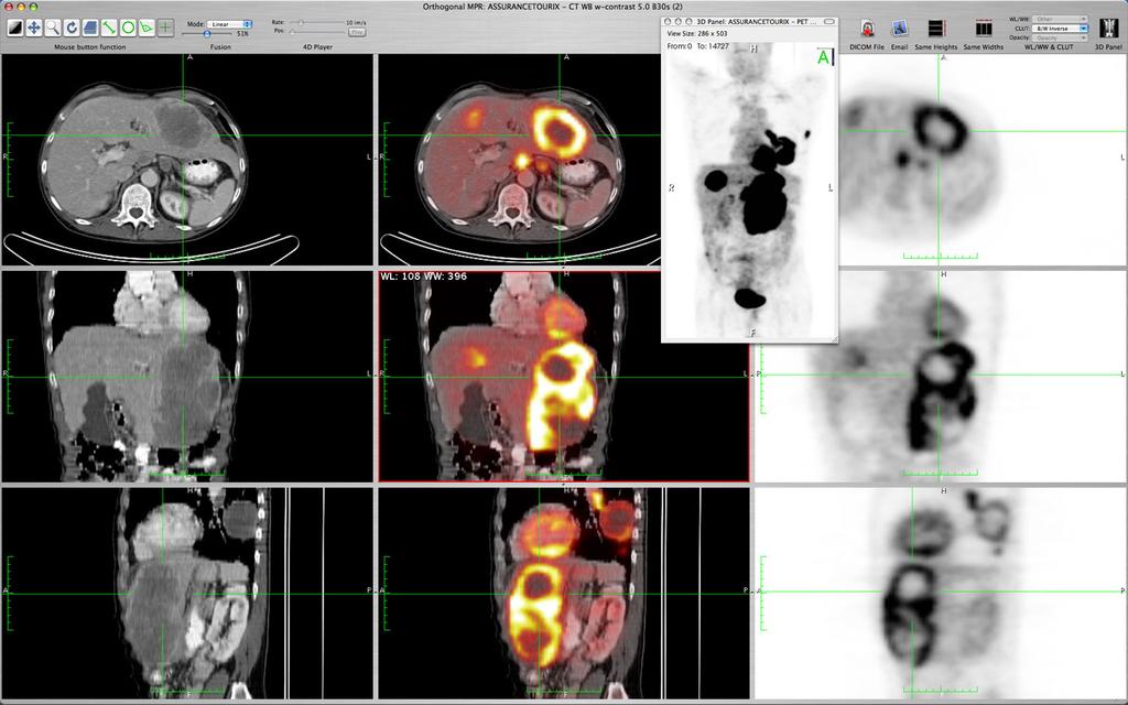 MANY Follow up of Talisman project on lung images Work closely with emergency radiology Quick response is required, not specialized in one image type