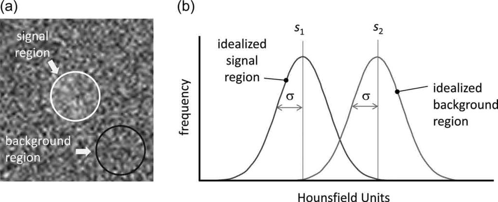 RADIATION DOSE AND IMAGE-QUALITY ASSESSMENT IN COMPUTED TOMOGRAPHY Figure 11.1. Basic concepts of signal and noise. (a) A circular signal region located in the center of a noisy image.