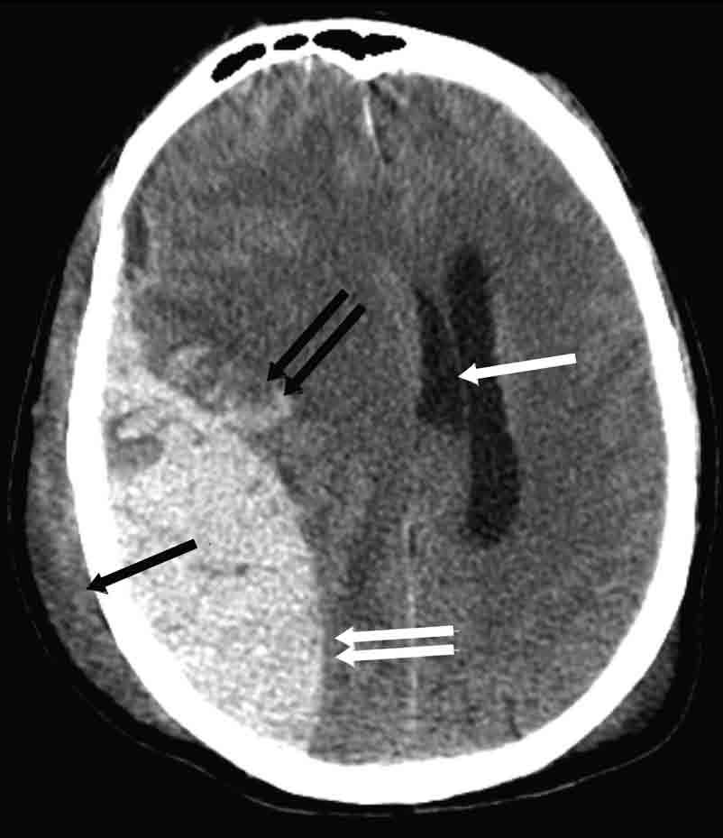 Images from a 27-year-old with head trauma.
