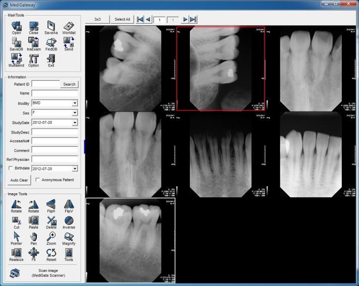 16 3-2-3 Close close all the images and patient s information and ready for new patient image and information.