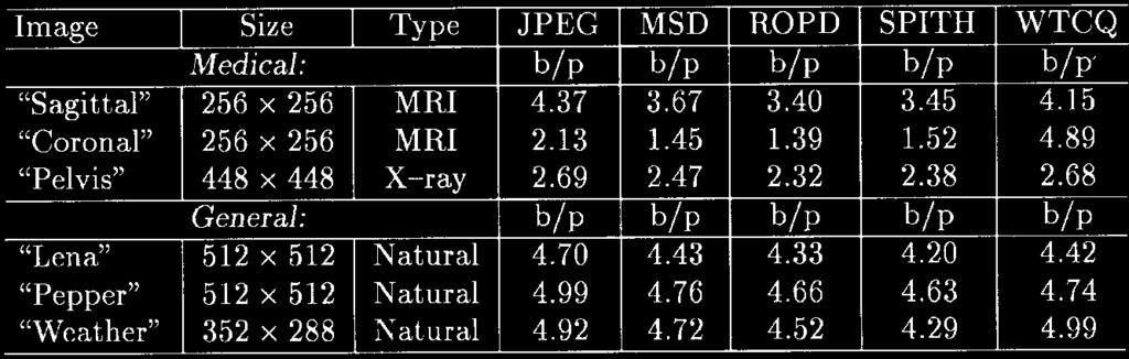 Table 5 Compression Comparison of MSD, ROPD, JPEG, SPITH, and WTCQ (a) (b) (c) (d) (e) (f) (g) (h) Fig. 46. Pelvis 448 2 448 pixels, lossless rate 2.32 bits/pixel.