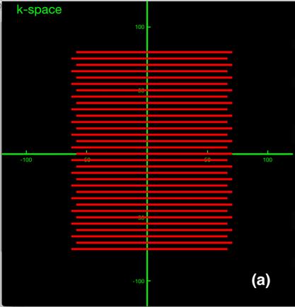 The trajectory during sampling is parallel to the k x -axis, i.e. frequency direction, in all cases for the sequences implemented in this work.