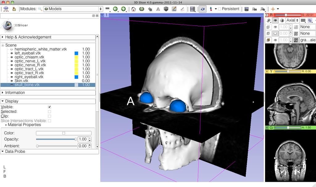 3D Visualization Turn off the visibility of the skull