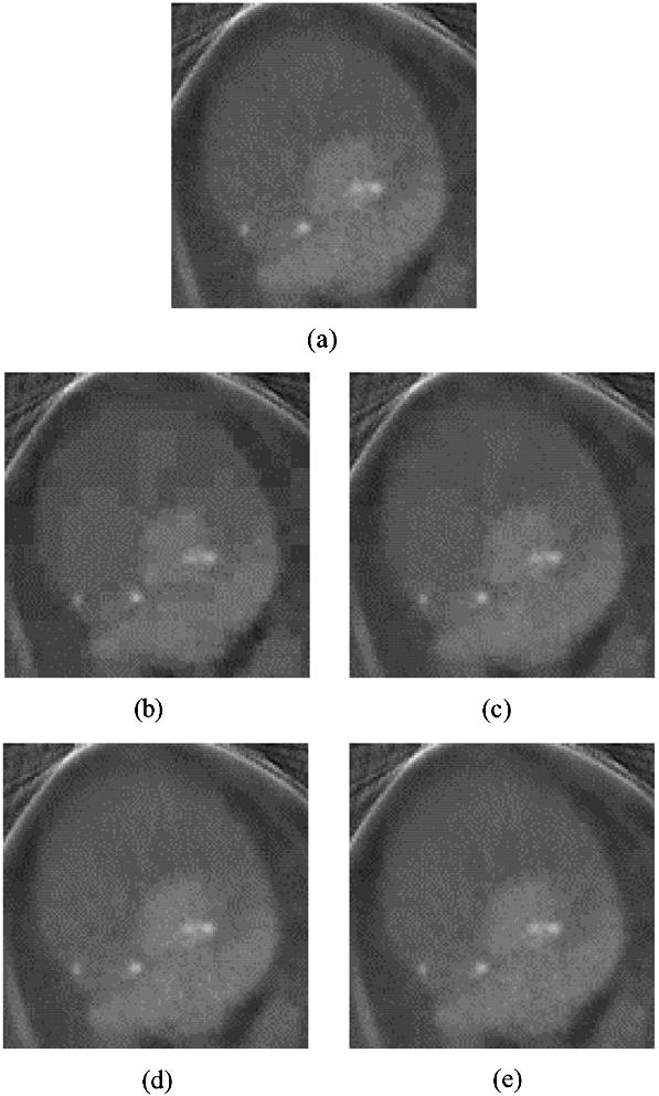 KASSIM et al.: MOTION COMPENSATED LOSSY-TO-LOSSLESS COMPRESSION OF 4-D MEDICAL IMAGES USING IWTs 137 Fig. 7. (a) Original 90th slice of the eighth volume of Sequence A (cardiac data).