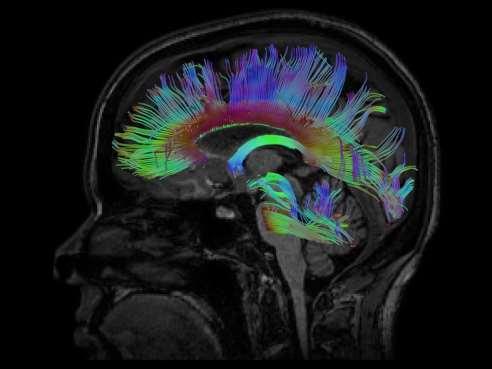 Deterministic Tractography Seed