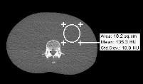 Machine round-off error X-ray Exposure (mas or Dose)