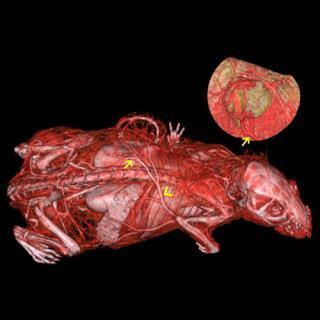 Implanted tumor 3D Rendered Airways 117 118 Quantitative with Extra Effort Lung Tumor Model Living and breathing