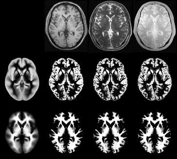 normalised BrainWeb phantoms (T1, T2 and PD) Optimum Tissue probability maps of GM and WM Alternate between optimising different