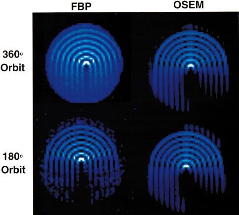 OSEM, and at large distances from the center of rotation is actually less than OSEM.