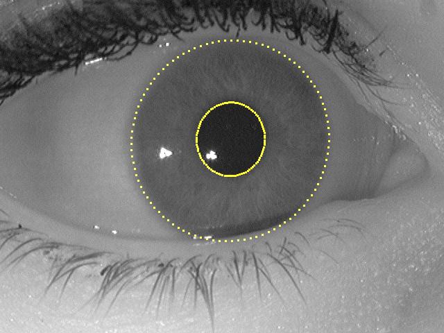 SEGMENTATION Since the ellipse fitting process is robust and includes eyelids, eyelashes, and reflections within the ellipse boundaries, the segmentation process is used to eliminate these remaining