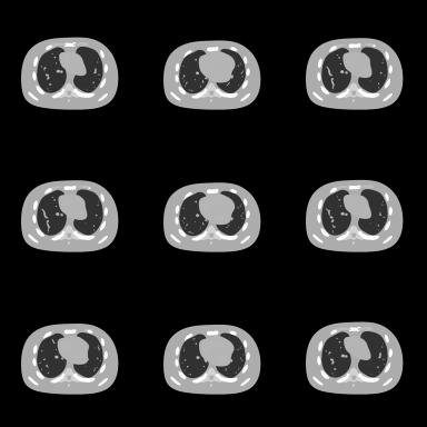 Cine-CBCT reconstruction 1 Figure 1. The ground truth cine-cbct images. From left to right, top to bottom: frame 4,8,...,36.