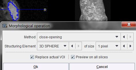 Please select the VOI to be modified in the list, then activate the Erosion/Dilation function from the VOI tools area.
