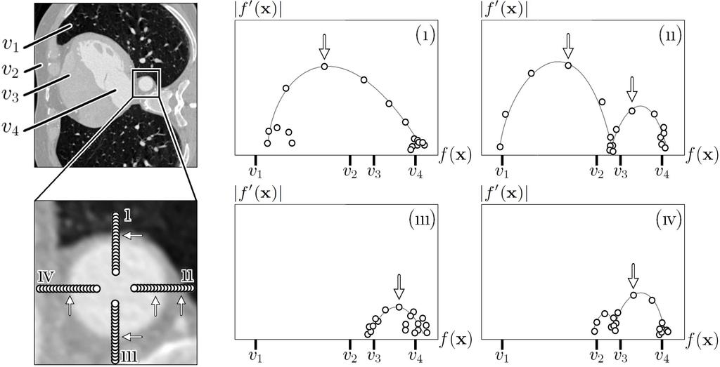 2D opacity transfer function 373 mathematical arch representations for later automatic 2-D OTF definition. Its performance is investigated with the focus on clinical application.