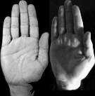with high accuracy. Given that hand detection is successfully accomplished, hand posture recognition can be done in a way that one classifier/detector is trained for each hand posture class [6].