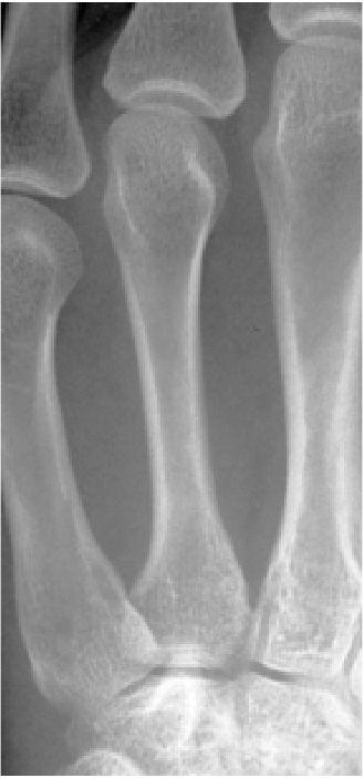 X-Ray Example: Bone Detection Input: Dataset: 50 images (30