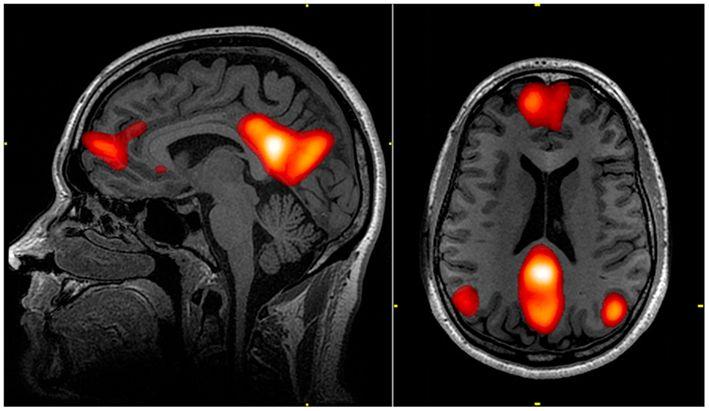 Medical Images Digital Pathology X-Ray CT - Computed Tomography MRI - Magnetic Resonance Imaging fmri - functional MRI OCT - Optical