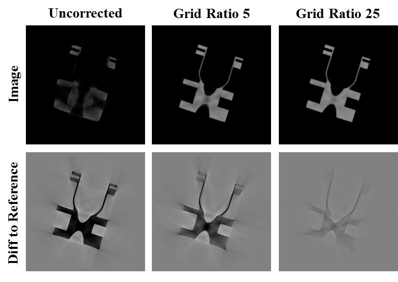 3.2 Anti-Scatter Grid In Figure 6 the influence of an anti-scatter grid that is mounted on top of the detector is shown. As can be seen, the image quality strongly increases with the grid ratio.