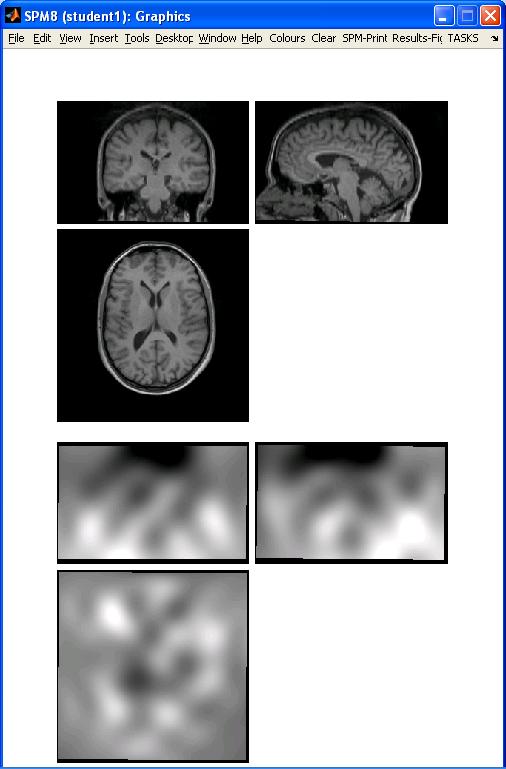 Preprocessing overview fmri time-series Anatomical MRI