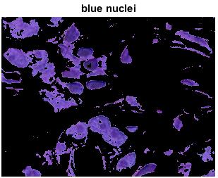 Application Colour-Based Image Segmentation Using K-means Step 6: Segment the nuclei into a separate image with the L* feature In cluster 1, there are dark and light blue objects (pixels).