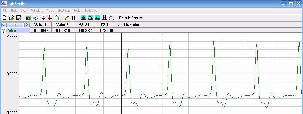 Figure 1-9: A finger pulse recording in the Analysis window. To select the data to be displayed in the Analysis window: 1.