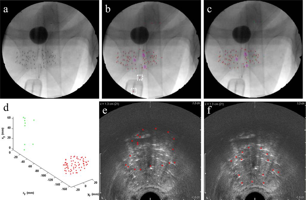 Kuo et al. Page 9 Figure 4. Images along the image processing pipeline. (a) Undistorted fluoroscopy image.