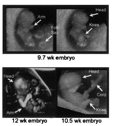 Images of embryos, demonstrating the degree of detail that can be shown using