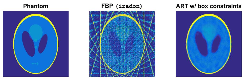 FBP Versus Algebraic Methods Limited data, or nonuniform distribution of projection angles or rays artifacts appear in FBP reconstructions. Difficult to incorporate constraints (e.g., nonnegativity) in FBP.