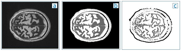 Example of model applied on MRI slices a) Input image Normal MRI. b) Downsampled image Input to the simulation has to be either B/W or with 4 levels of grey.