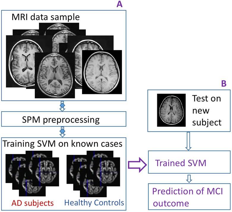Procedure Run the same analysis twice: Train SVM with the original MRI scans. Train SVN with the filtered MRI scans. Compare! Del Viva filter preprocessing.
