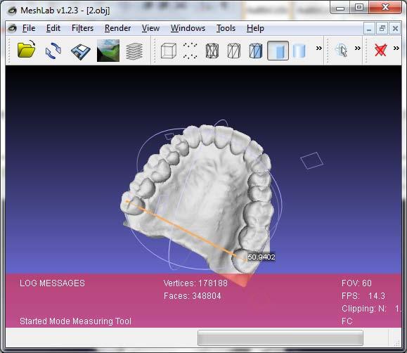 5.09 Figure 6. Arch width measurement The above examples are presented through MeshLab, which is a very simple to use 3D processing software.