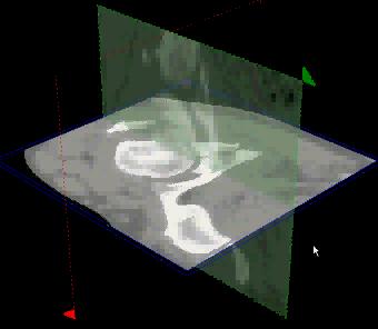 Globally otimal surfaces in 3D