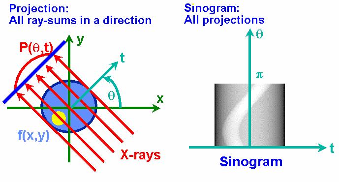 Projection & Sinogram Computed tomography (CT):