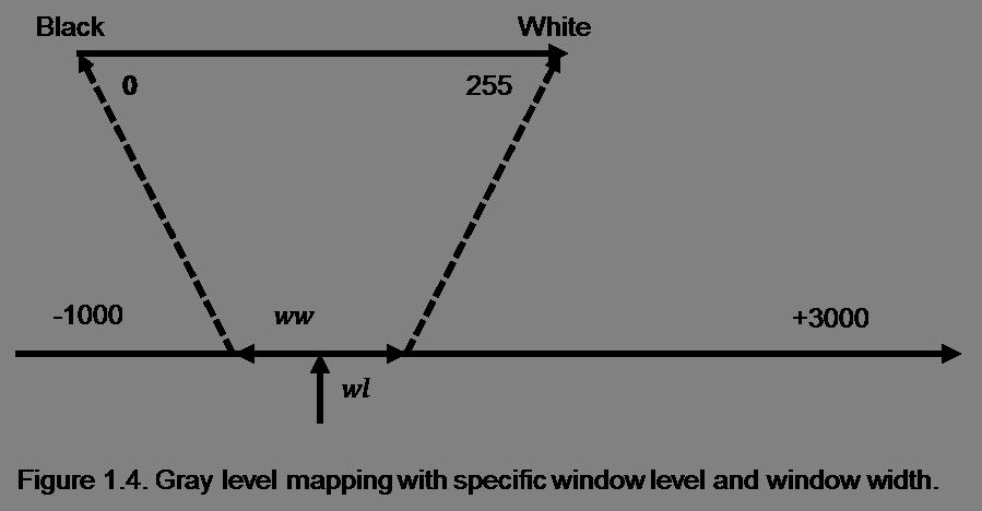 the nature of possible pathologies. Figure 1.5 illustrates the effect of different window level and window width selections on the image display.