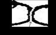 touching. Fig 24 : Final segmentation path Step 3: Closed loops = 3 or 4.