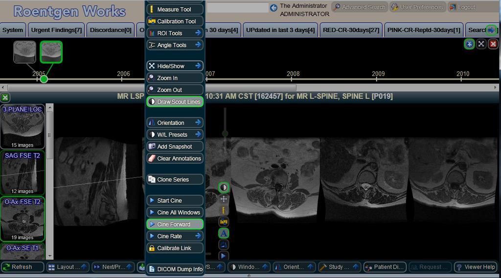 ADVANCED, MULTI-MONITOR VIEWING TOOLS WebWorks provides many advanced imaging tools, often found only in client-based applications.