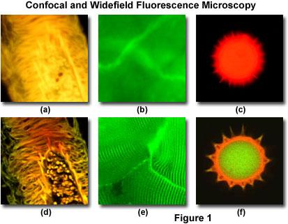 Confocal images Confocal advantages: -Blocks out of focus light rays, increasing resolution and
