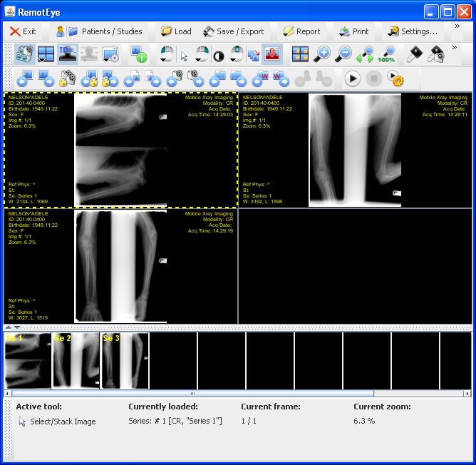 User Guide Technologist Supplement The RemotEye viewer will load and display the images.